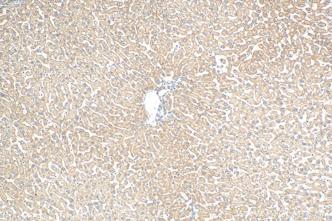 NDUFA9 Antibody in Immunohistochemistry (Paraffin) (IHC (P))