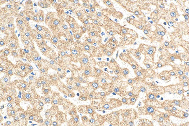 NDUFA9 Antibody in Immunohistochemistry (Paraffin) (IHC (P))