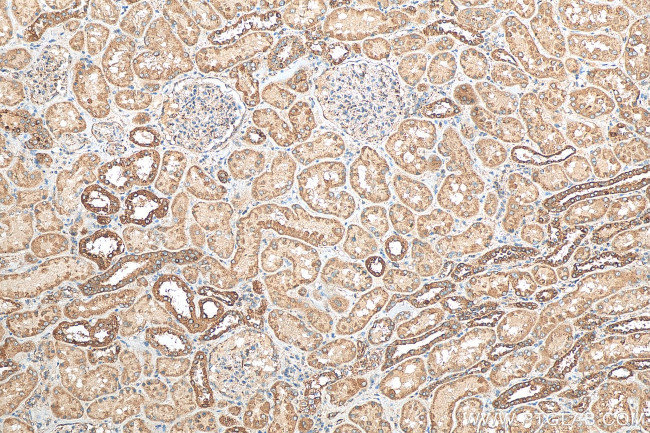 PPT1 Antibody in Immunohistochemistry (Paraffin) (IHC (P))