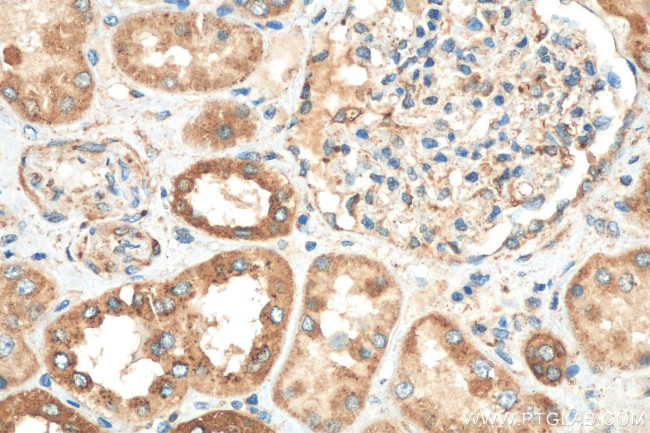 PPT1 Antibody in Immunohistochemistry (Paraffin) (IHC (P))