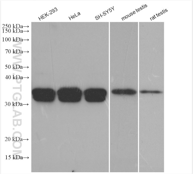 PPT1 Antibody in Western Blot (WB)