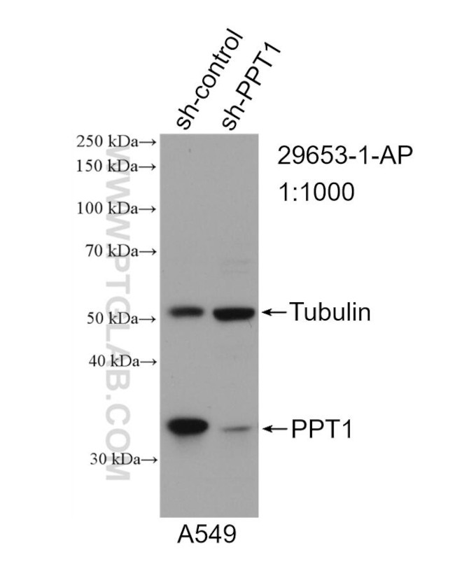 PPT1 Antibody in Western Blot (WB)