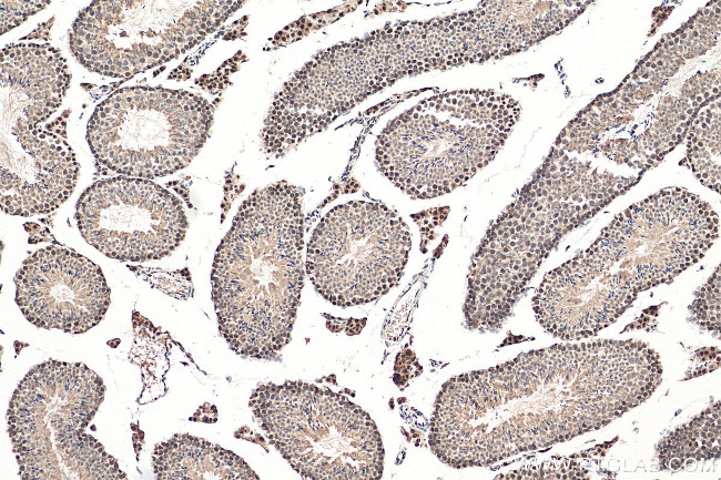 DIS3 Antibody in Immunohistochemistry (Paraffin) (IHC (P))