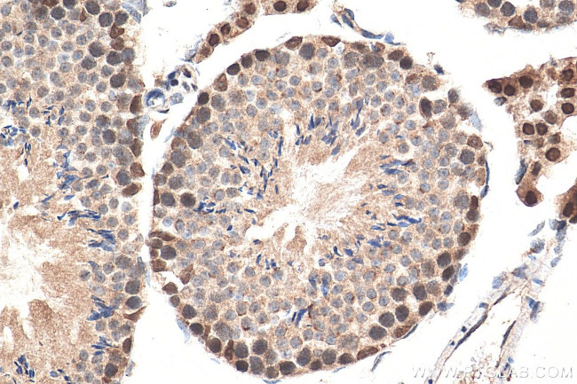 DIS3 Antibody in Immunohistochemistry (Paraffin) (IHC (P))