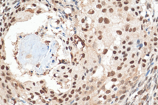 DIS3 Antibody in Immunohistochemistry (Paraffin) (IHC (P))