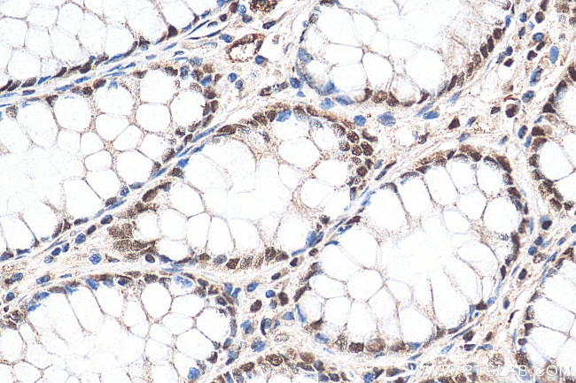 DIS3 Antibody in Immunohistochemistry (Paraffin) (IHC (P))