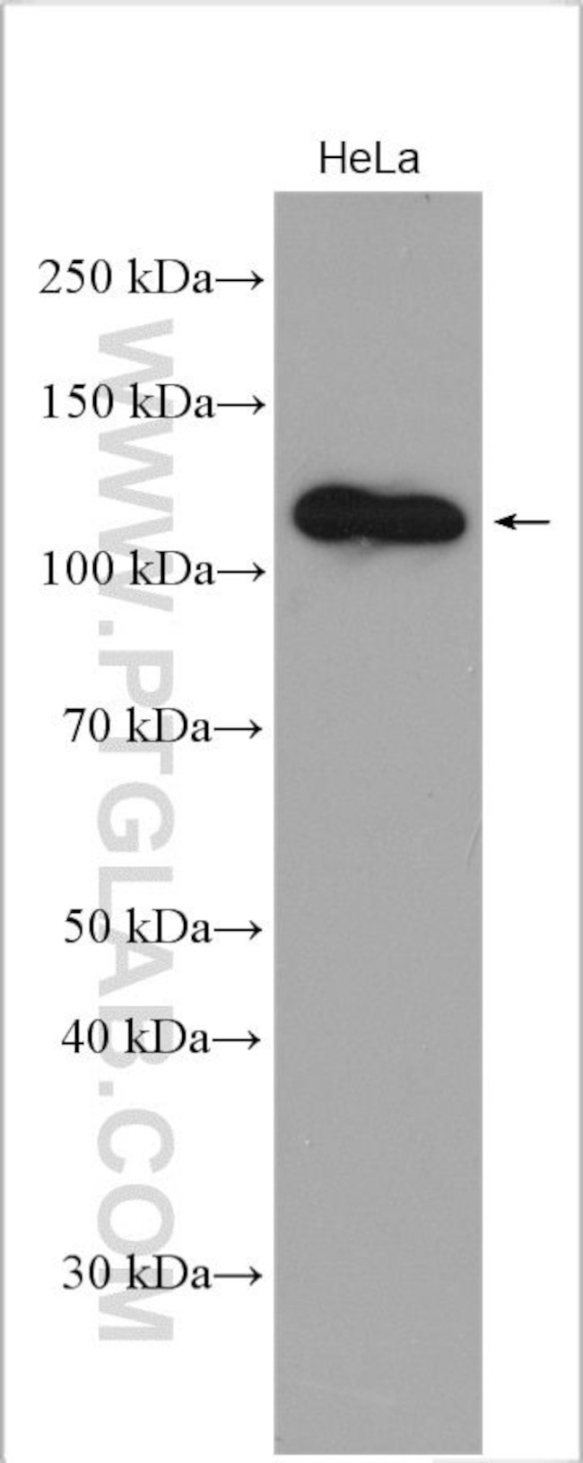 DIS3 Antibody in Western Blot (WB)