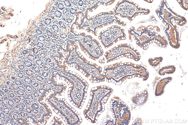 HTR3A Antibody in Immunohistochemistry (Paraffin) (IHC (P))