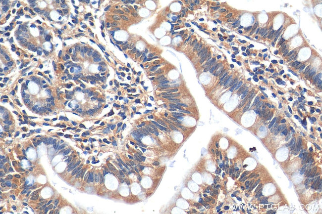 HTR3A Antibody in Immunohistochemistry (Paraffin) (IHC (P))