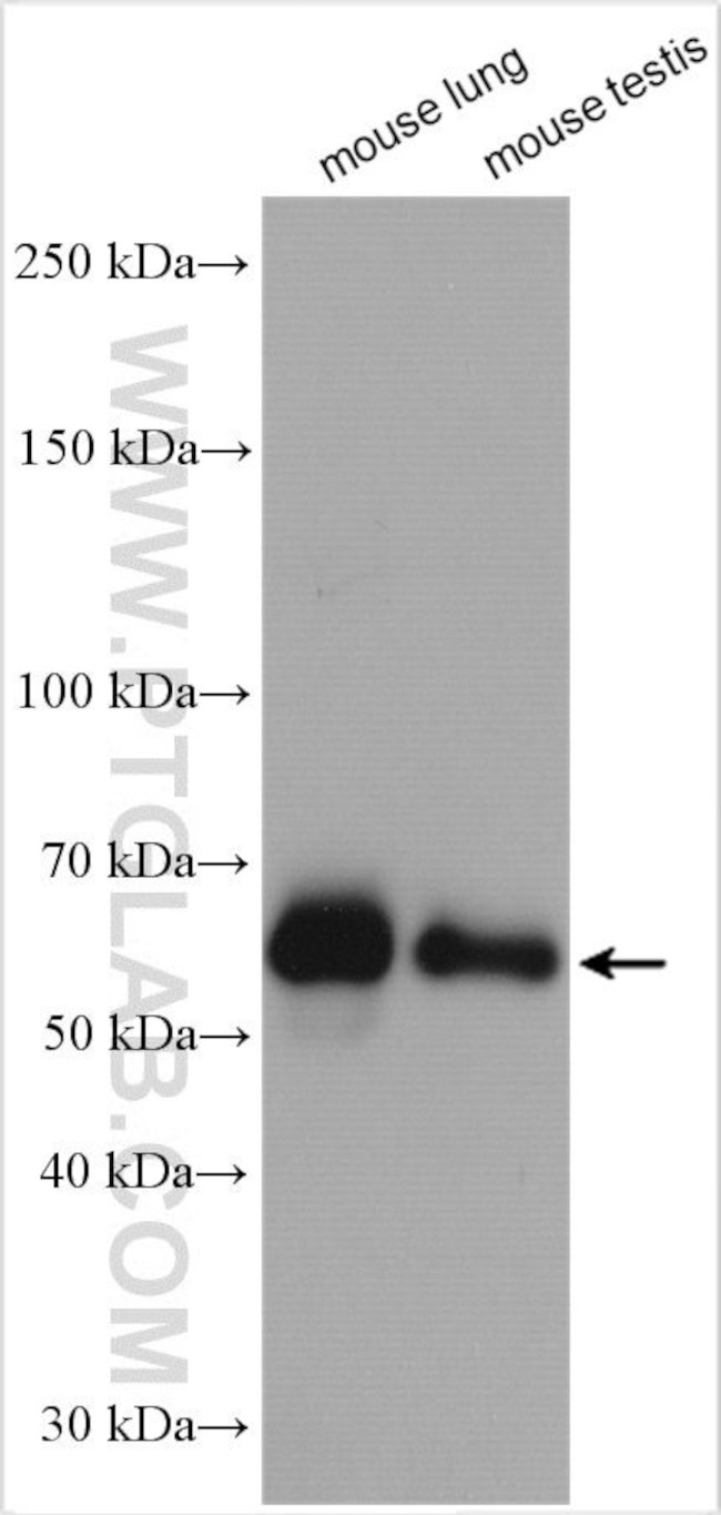 HTR3A Antibody in Western Blot (WB)