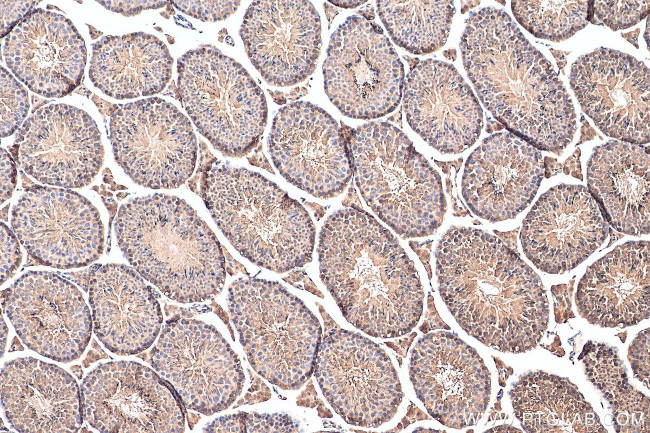 GGPS1 Antibody in Immunohistochemistry (Paraffin) (IHC (P))