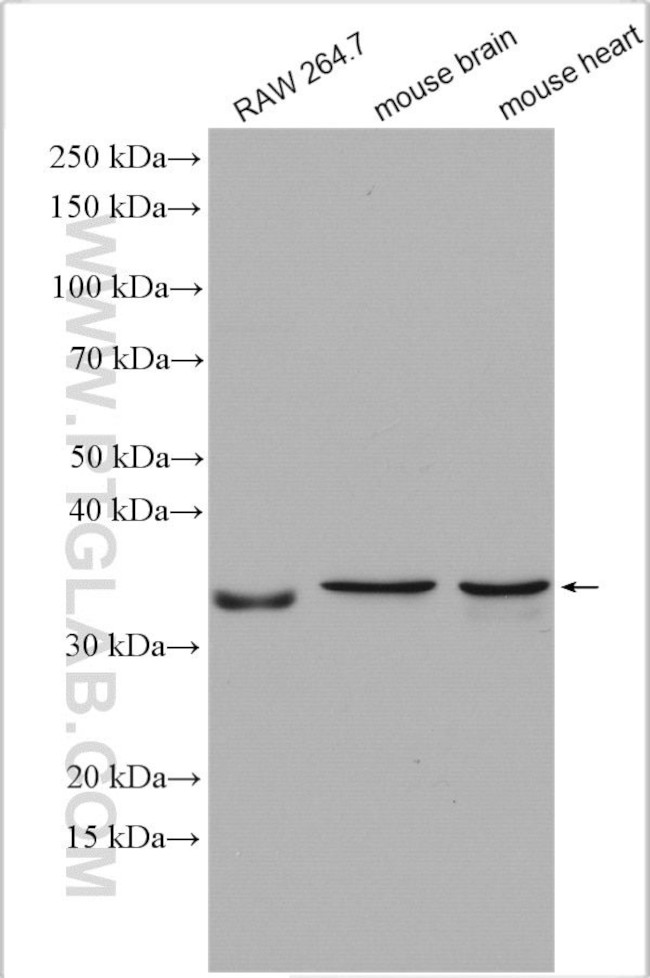 GGPS1 Antibody in Western Blot (WB)