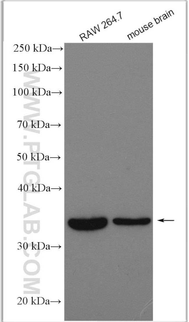 GGPS1 Antibody in Western Blot (WB)