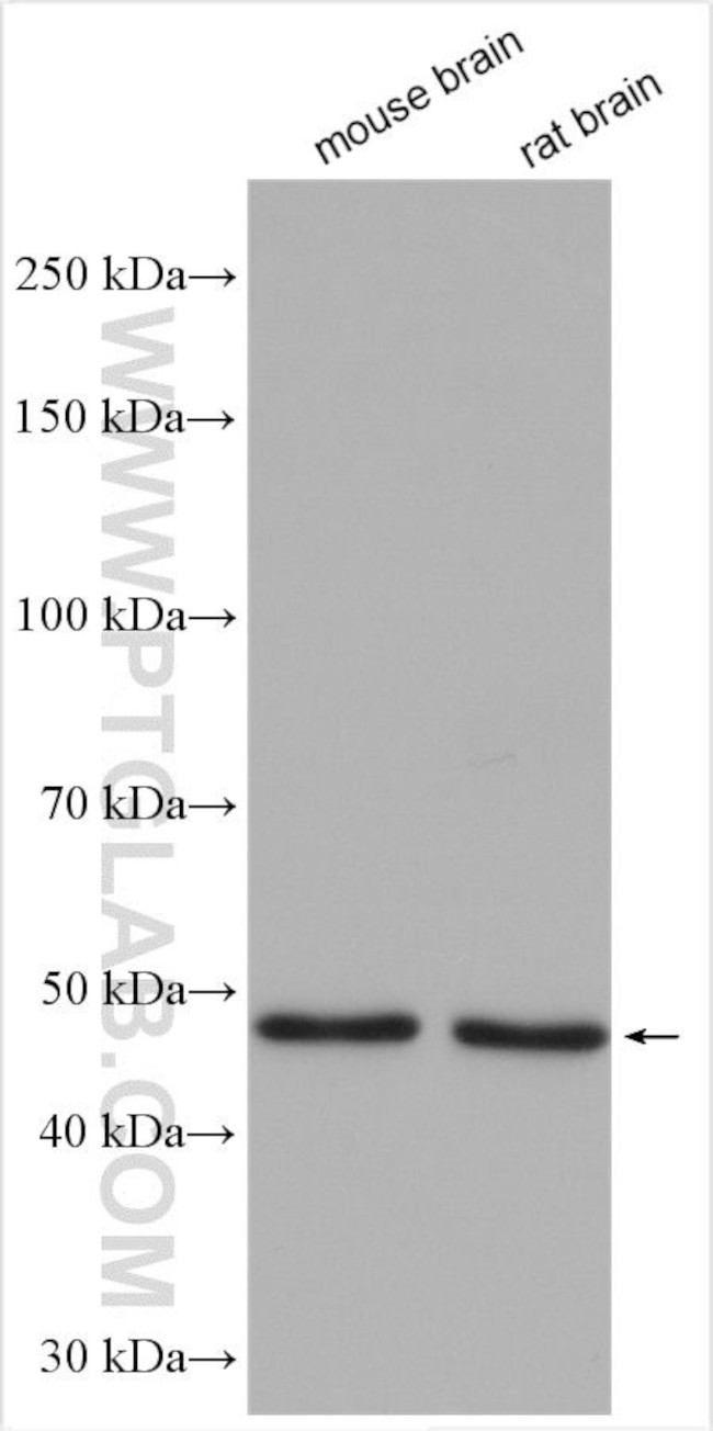 Cannabinoid receptor 1 Antibody in Western Blot (WB)