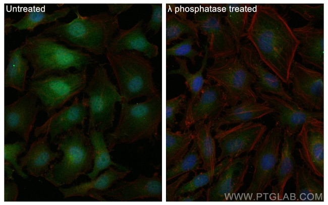 Phospho-Cofilin (Ser3) Antibody in Immunocytochemistry (ICC/IF)