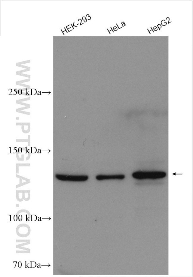 DHX37 Antibody in Western Blot (WB)