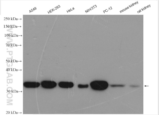 STUB1 Antibody in Western Blot (WB)