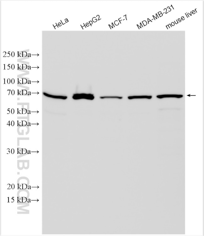 SHH Antibody in Western Blot (WB)