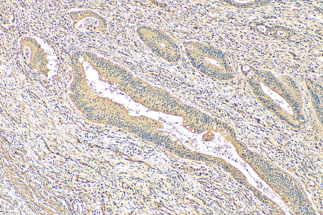 FMNL3 Antibody in Immunohistochemistry (Paraffin) (IHC (P))