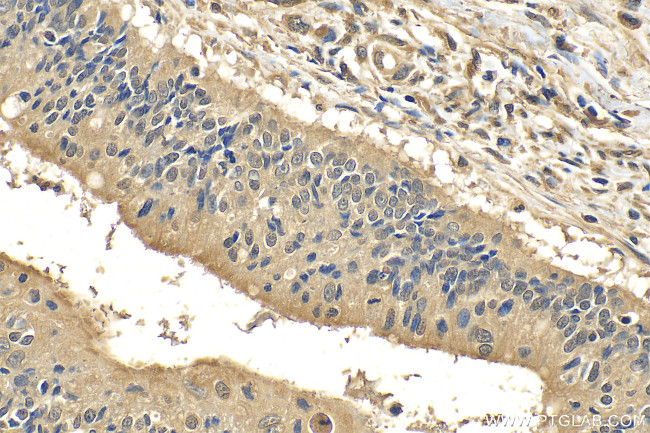 FMNL3 Antibody in Immunohistochemistry (Paraffin) (IHC (P))