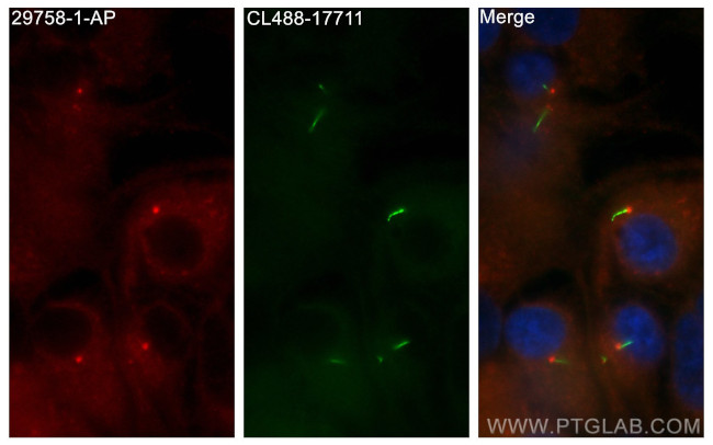 DYNC2H1 Antibody in Immunocytochemistry (ICC/IF)