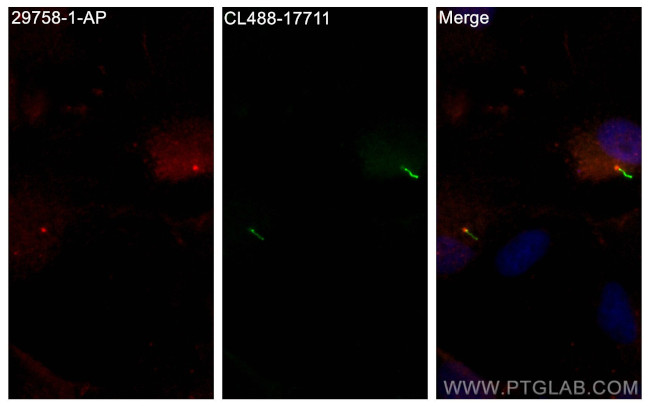 DYNC2H1 Antibody in Immunocytochemistry (ICC/IF)