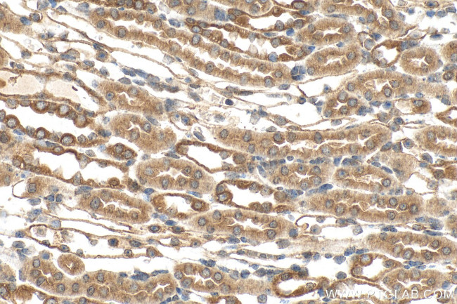 DYNC2H1 Antibody in Immunohistochemistry (Paraffin) (IHC (P))