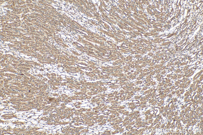 DYNC2H1 Antibody in Immunohistochemistry (Paraffin) (IHC (P))