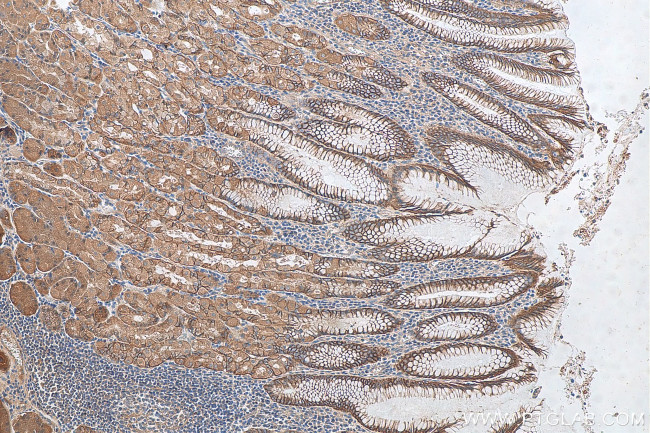 NHE1 Antibody in Immunohistochemistry (Paraffin) (IHC (P))