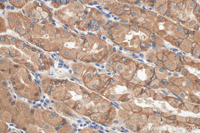 NHE1 Antibody in Immunohistochemistry (Paraffin) (IHC (P))