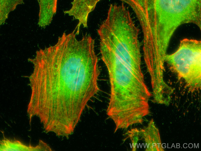 EBP50/NHERF-1 Antibody in Immunocytochemistry (ICC/IF)