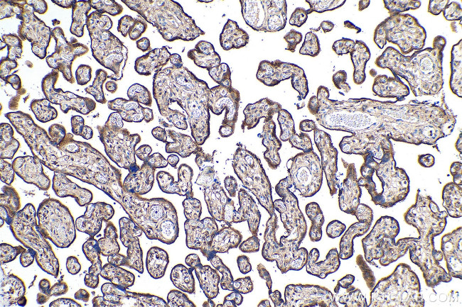 EBP50/NHERF-1 Antibody in Immunohistochemistry (Paraffin) (IHC (P))