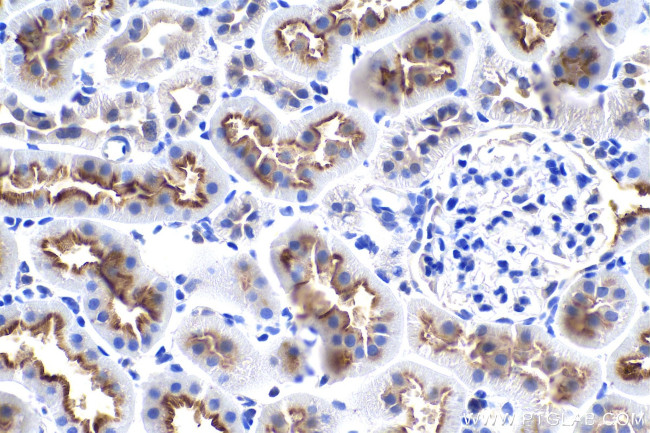 EBP50/NHERF-1 Antibody in Immunohistochemistry (Paraffin) (IHC (P))