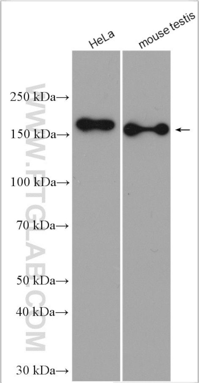 RPGRIP1L Antibody in Western Blot (WB)