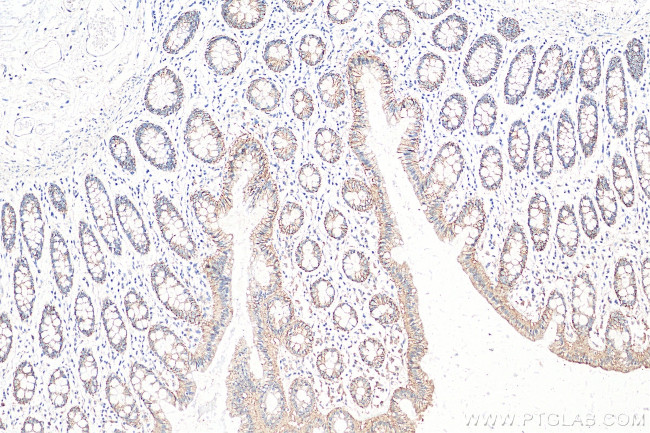 Claudin 7 Antibody in Immunohistochemistry (Paraffin) (IHC (P))