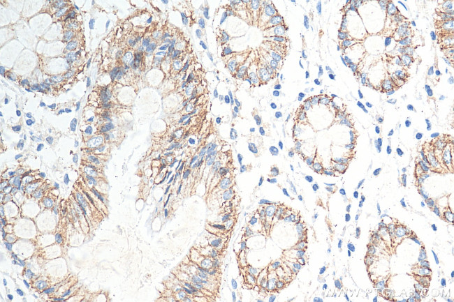 Claudin 7 Antibody in Immunohistochemistry (Paraffin) (IHC (P))