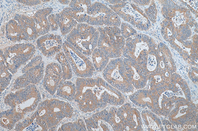 SRX1 Antibody in Immunohistochemistry (Paraffin) (IHC (P))