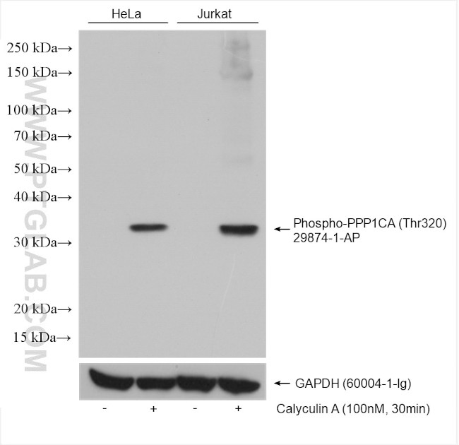 Phospho-PPP1CA (Thr320) Antibody in Western Blot (WB)