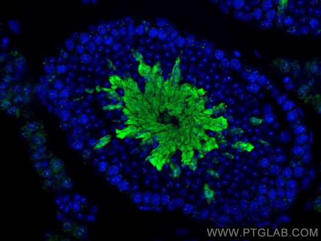 MGC33407/ACTL9 Antibody in Immunohistochemistry (Paraffin) (IHC (P))