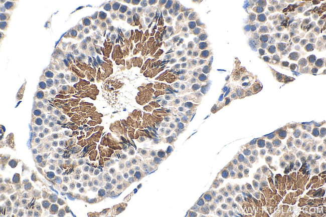 MGC33407/ACTL9 Antibody in Immunohistochemistry (Paraffin) (IHC (P))