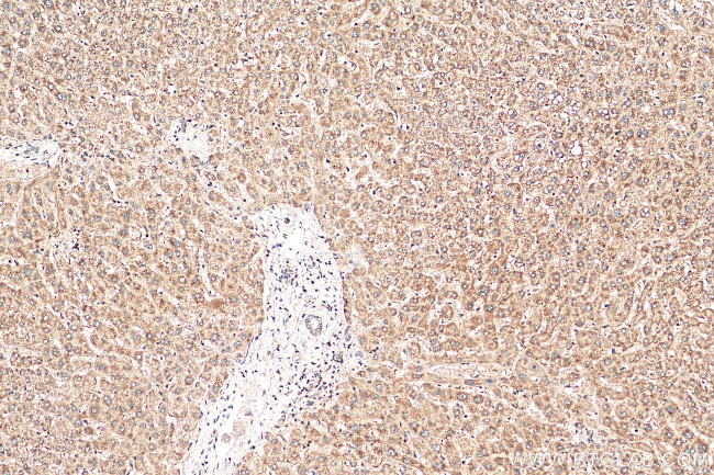 MGC33407/ACTL9 Antibody in Immunohistochemistry (Paraffin) (IHC (P))