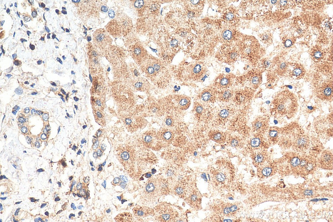 MGC33407/ACTL9 Antibody in Immunohistochemistry (Paraffin) (IHC (P))