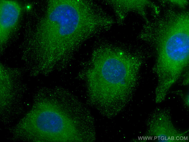 PFKFB4 Antibody in Immunocytochemistry (ICC/IF)