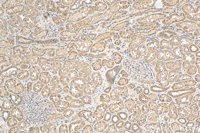 PFKFB4 Antibody in Immunohistochemistry (Paraffin) (IHC (P))