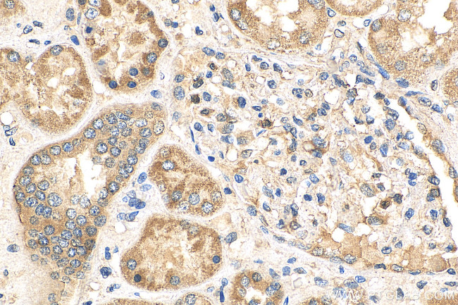 PFKFB4 Antibody in Immunohistochemistry (Paraffin) (IHC (P))