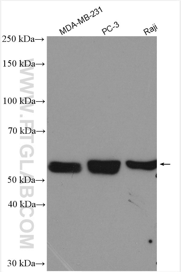 PFKFB4 Antibody in Western Blot (WB)