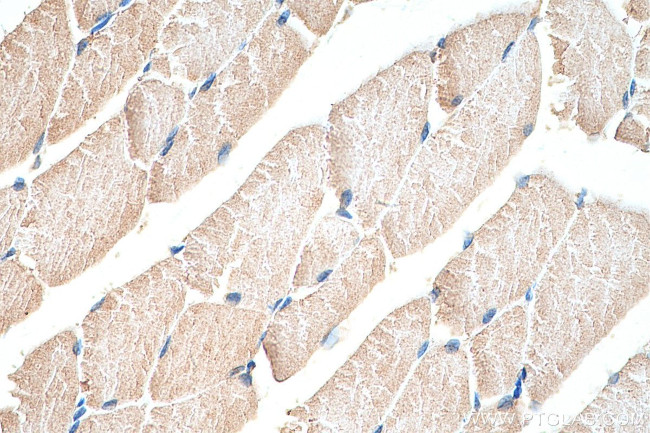 Hamartin/TSC1 Antibody in Immunohistochemistry (Paraffin) (IHC (P))