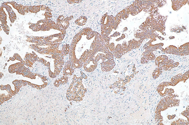 GALR2 Antibody in Immunohistochemistry (Paraffin) (IHC (P))