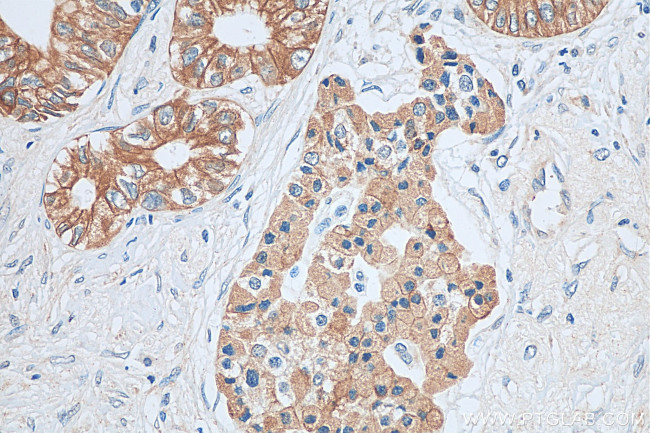 GALR2 Antibody in Immunohistochemistry (Paraffin) (IHC (P))