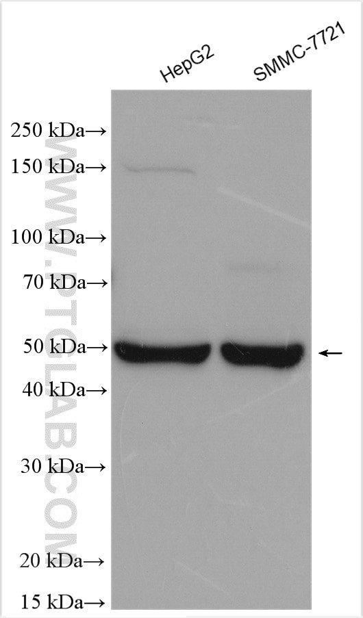 GALR2 Antibody in Western Blot (WB)